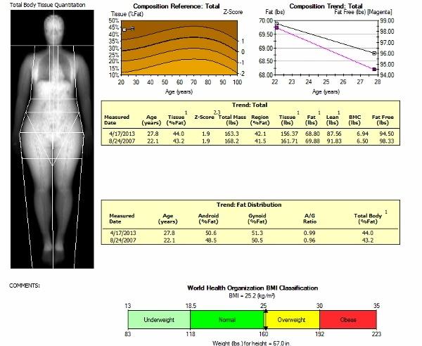 **NEW SERVICE** DEXA Total Body Composition Scanning Merivale Medical Imaging has recently started performing DEXA total body composition scanning.