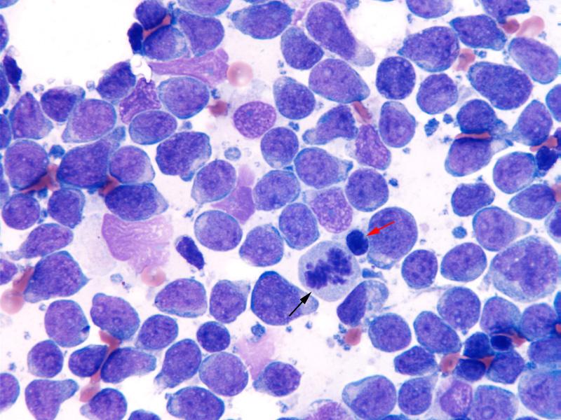 Lymphoma detected in a lymph node aspirate from a dog Surgical Biopsy: Given the potential limitation of aspiration with cytology, occasionally a surgical biopsy of affected tissue is required to