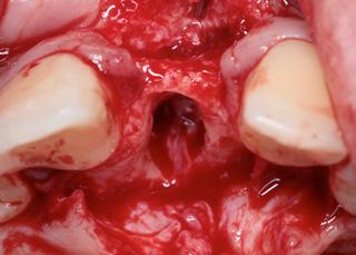 Related Cases Dentium s regeneration products