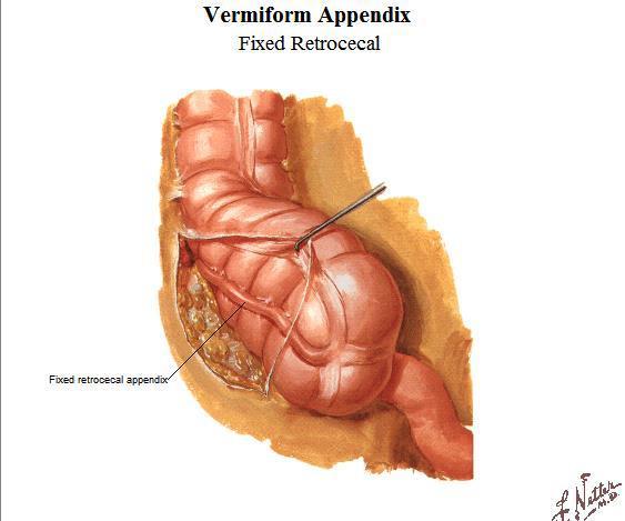pelvic appendix o Most are found tucked behind the large intestine = retrocaecal appendix - Largest solid viscera found tucked up behind the costal margin - Fills the RUQ - The anterior