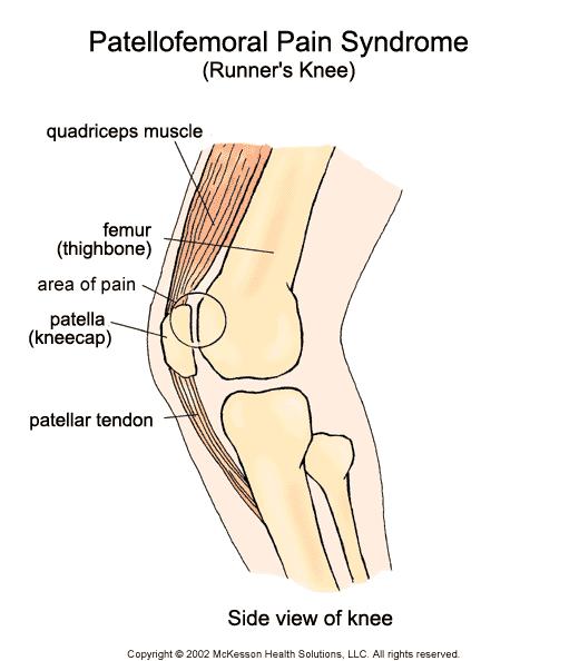 Patellofemoral Pain Syndrome Rehabilitation Exercises Patient Education Handout associated with UMHS Clinical Care Guideline You can do the hamstring stretch right away.
