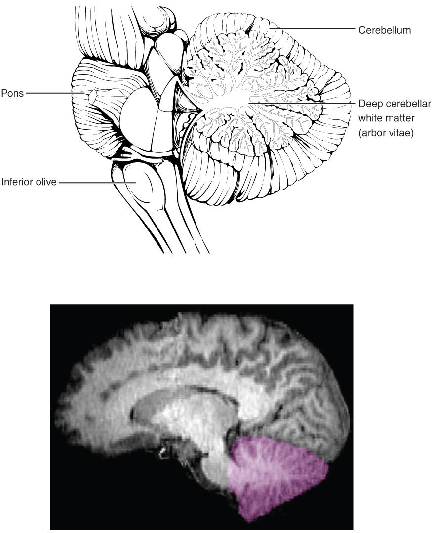 The Cerebellum The cerebellum, as the name suggests, is the little brain. It is covered in gyri and sulci like the cerebrum, and looks like a miniature version of that part of the brain ([link]).