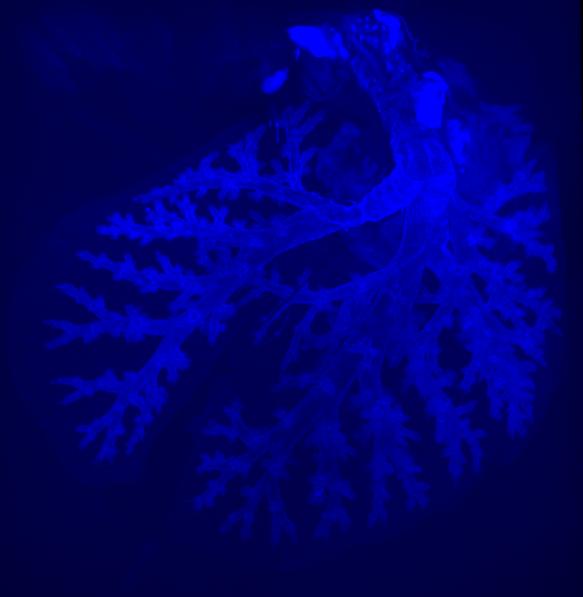 autofluorencence of whole lung imaged using LSM at excitation and emission (ex/em)