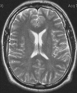 IMAGING METHODS MRI direct method signal