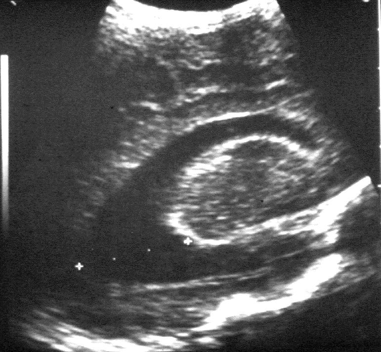 IMAGING METHODS Ultrasonography newborn, infant
