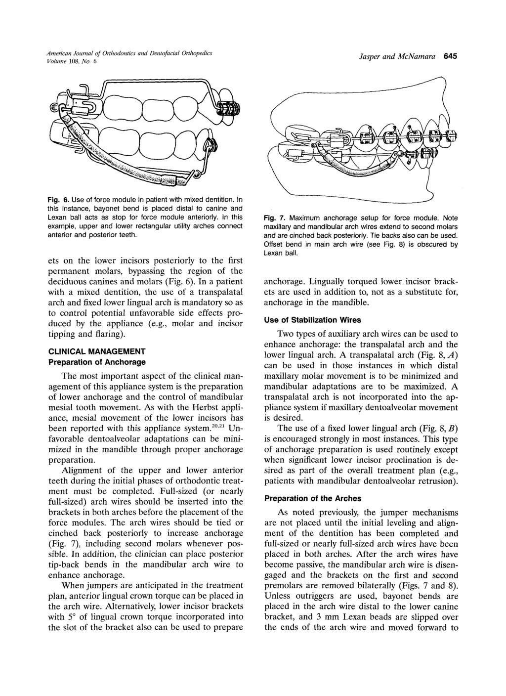 American Journal of Orthodontics and Dentofacial Orthopedics Jasper and McNamara 645 Volume 108, No. 6 Fig. 6. Use of force module in patient with mixed dentition.