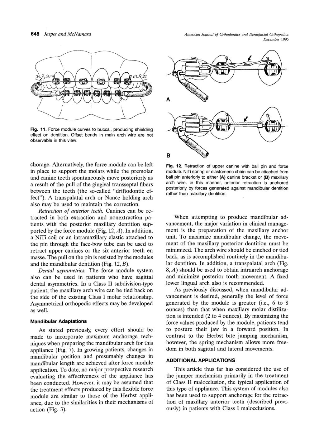 648 Jasper and McNamara American Journal of Orthodontics and Dentofacial Orthopedics December 1995 Fig. 11. Force module curves to buccal, producing shielding effect on dentition.