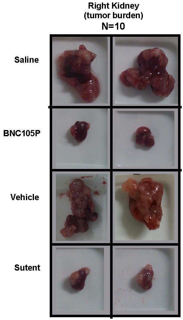 BNC105: Potential paradigm shift in renal cancer treatment BNC105 has the potential to represent an entirely new treatment paradigm for patients with renal cancer BNC105 is as effective as Sutent in