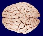 It also contains a prominent stripe of white matter in its layer 4 -