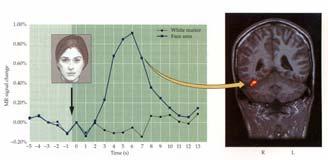 Human Face Center Temporal Cortex Damage In humans, functional brain imaging shows activity change in the right temporal lobe