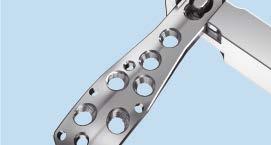5 mm Reconstruction Plates Select a plate length appropriate for the fracture.