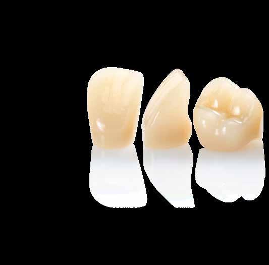 Expressive and individual The shade intensity, brilliance and translucency of these tooth lines closely imitate the properties of natural teeth, resulting in dental prostheses that integrate