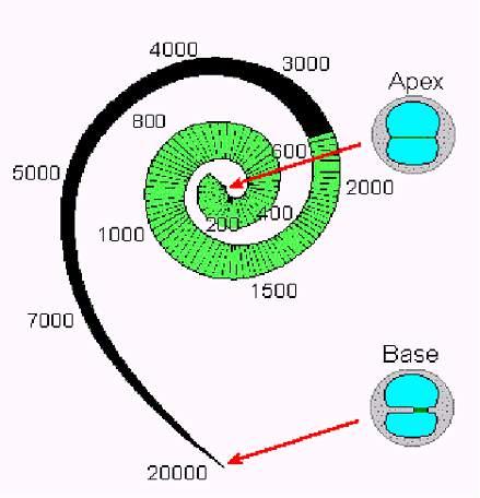 There are no neurons coming from the basal part of the cochlea, indicating a dead region.