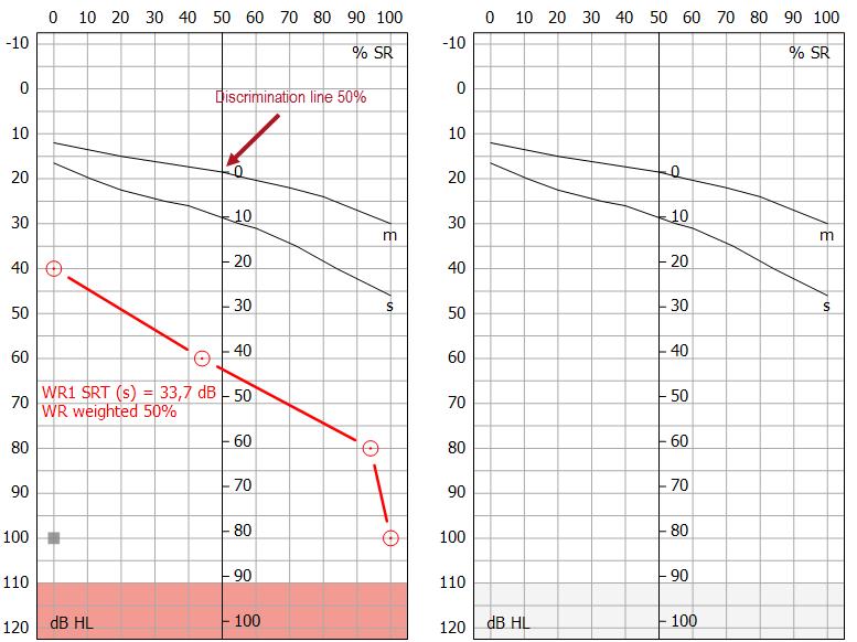 Callisto Additional Information Page 14 Dual Speech Graphs The graphs can be shown as a dual audiogram to show left
