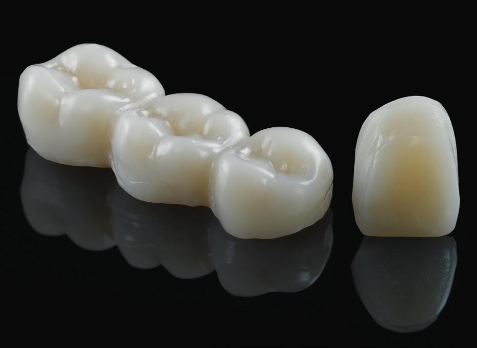 The result: exceptionally stable High flexural strength combined with high impact strength reduces the risk of the temporary restoration fracturing in the mouth as a result of high or sudden