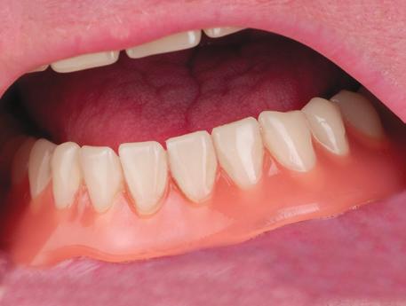 dentist Optimum requirements for hygienic denture conditions