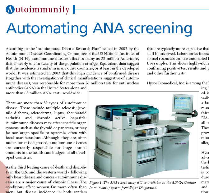 The ANA IIF Test Characteristics Sensitive for SLE, Not Specific Modern Hep-2 ANA IIF is nearly 99% sensitive for SLE (90% sensitive for scleroderma, etc.