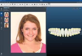 feature \\ case presentation Virtual Treatment Planning Reduce Frustration with The Right Sequence Jamie Reynolds, DDS, MS Virtual treatment planning that directs the fabrication of customized