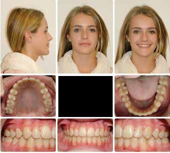 from the general to the specific can greatly improve planning and treatment efficiency. References 1. Eastham, R. Relationship of the maxillary incisor to the soft-tissue facial plane.