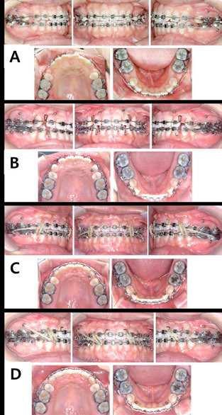 198 Issues in Contemporary Orthodontics Figure 9. A.