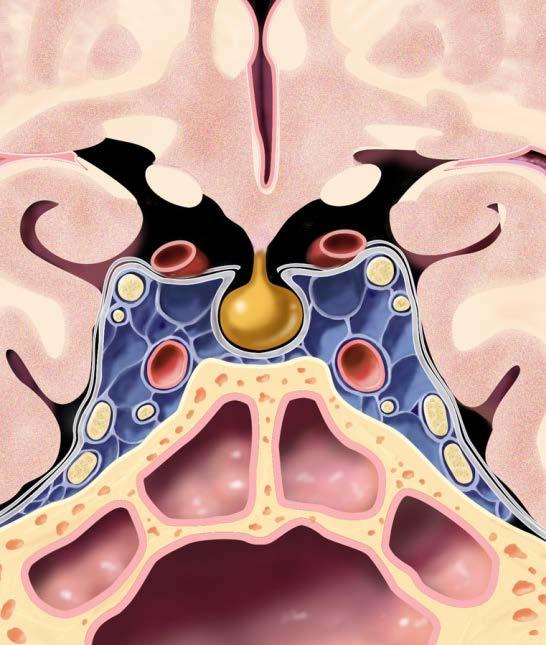 Cavernous Sinus Cranial Nerves