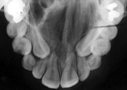 and molar occlusion. 5.