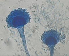 Multicellular organisms, with hyphae, and they often produce specific spore-producing structures Microscopic appearance (x 400 magnification) Culture appearance Culture appearance Examples Candida