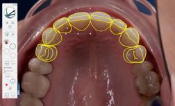 In yellow is the ideal position of the teeth according to the