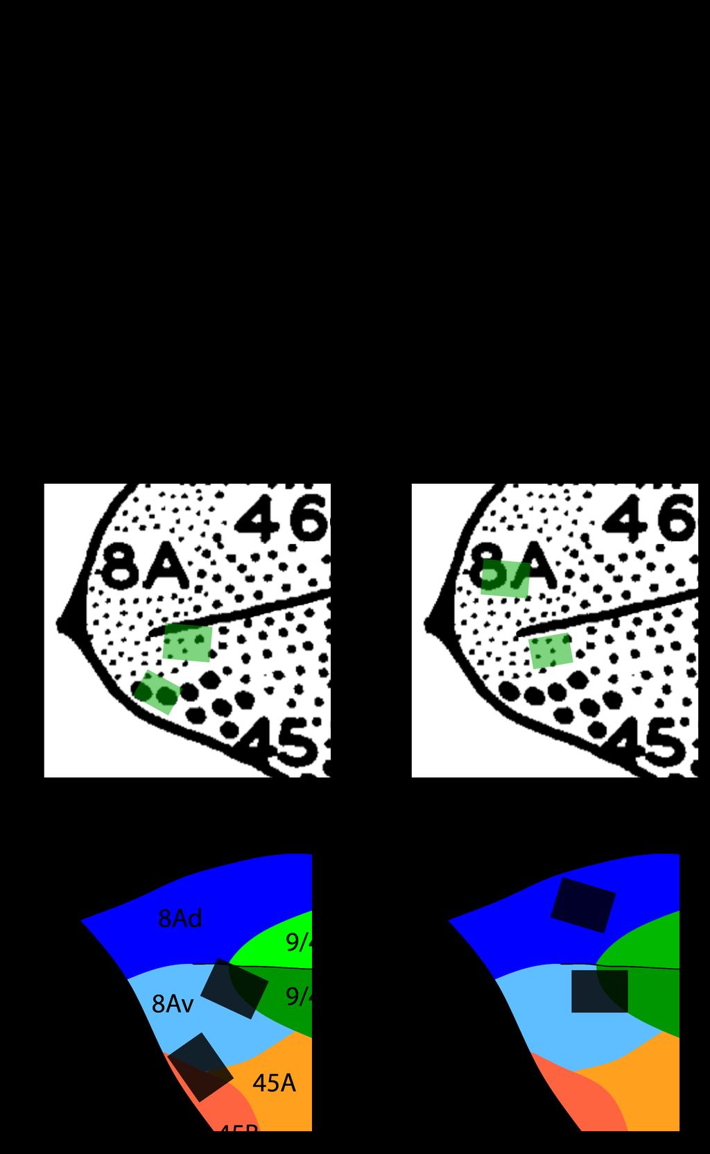 Figure S2. Anatomical locations of microelectrode arrays. Related to STAR Methods. (A) Microelectrode arrays placement relative to frontal sulci.