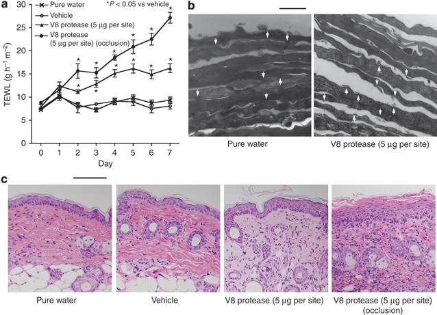 S. aureus extracellular protease causes epidermal barrier dysfunction ** *** ** V8 protease induced structural disturbance of the SC, including loss of corneodesmosome integrity & loss of corneocyte