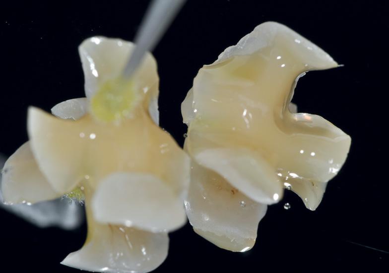 material delivers precise impressions using a 1-step or 2-step technique for dental crown and