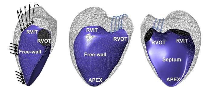 RV shape RV regional curvature The apical free wall becomes more pointed (black arrows at apex), and the body free wall flattens, as do the RVOT and RVIT