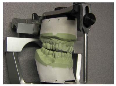 Mounting models on the articulator Occlusal analysis of study models Hands on Practical The facebow record