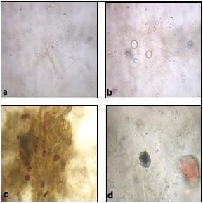 Figure 1: Powder microscopy of Draksha Figure 3: Powder microscopy of
