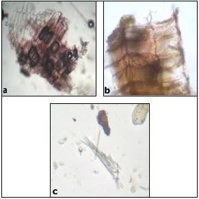 of Chandana Figure 4: Powder microscopy of Ashwagandha border pitted