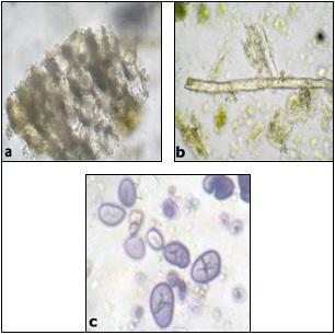 Figure 5: Powder microscopy of Vidari Figure 7: Powder