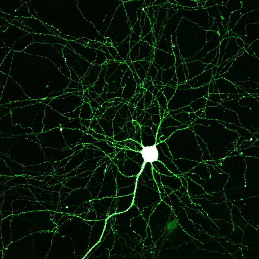 The Neuron brain cell Receive info -100