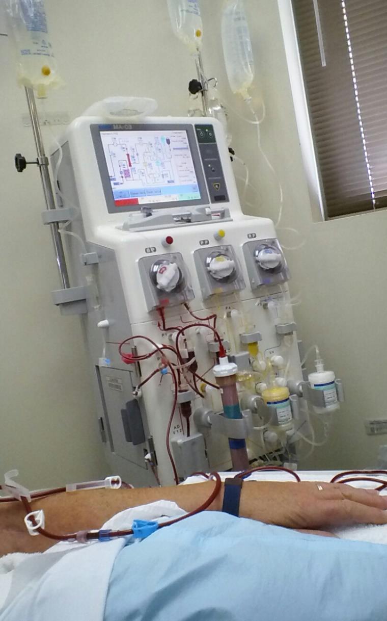 Lipoprotein apheresis Lipoprotein apheresis should be considered in all patients with homozygous or compound