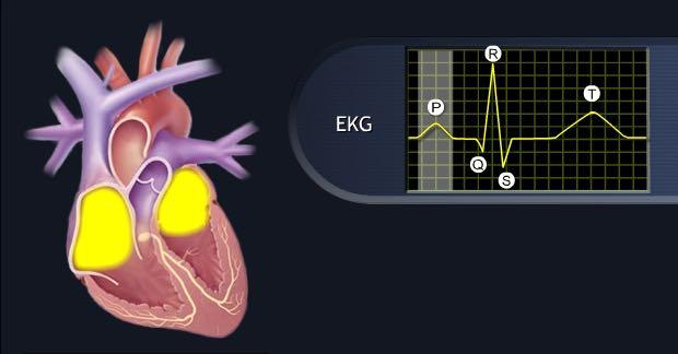 Action Potential - Tissue The elementary signal of the heart It affects the conduction velocity and signal passage of the tissue.