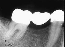 Middle: Patient presents with periodontal