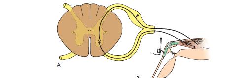 A reflex arc involving only one synapse is referred to as a monosynaptic reflex arc.