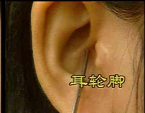 Auricular Helix Tubercle: The nodular process on the postero-superior portion of the auricle.