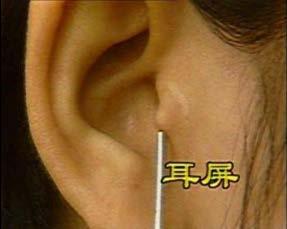Auricular Surface Anatomy Tragus: The cartilaginous projection or rounded flap in front of the auricle anterior to the ear opening.