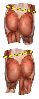 This causes rotational forces between the tibial plateau and the femoral condyle of the knee.