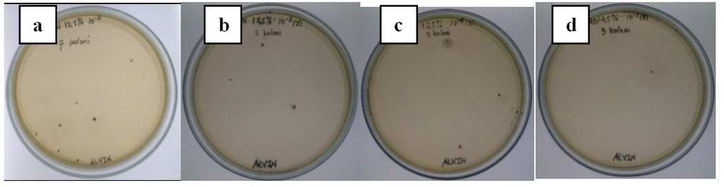 1 10 8 CFU/ml, (b) Replication II 2, 1 10 8 CFU/ml, (c) Replication III 2, 8 10 8 CFU/ml, (d) Replication IV 3, 2 10 8 CFU/ml Figure 4: Test Results of Concentration 12, 5% Which Shows Bacterial