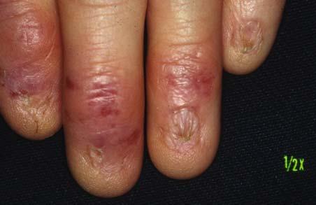 patient with scleroderma Fig. 2.28.