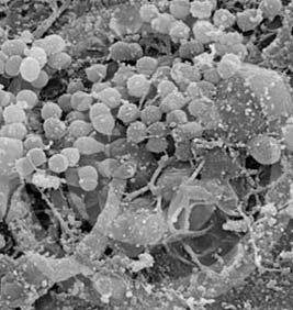 1. Microorganisms of the oral cavity Who lives here? Bacteria, viruses, fungi http://www.scharfphoto.