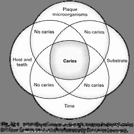 Dental caries: a multifactorial disease 25 Impact of dental caries 98% of population infected