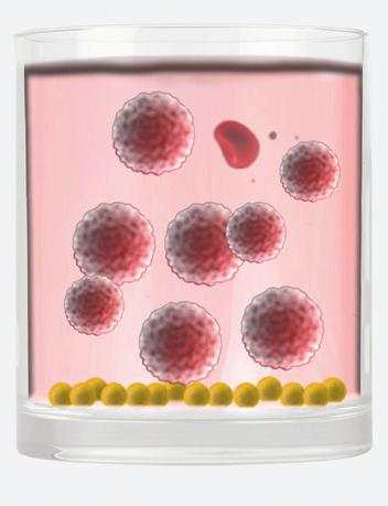 How is the test performed? 5 White blood cells are isolated from whole blood and tested against the foreign material chosen.