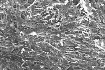 18 Regeneration Bone Grafting & Soft Tissue Management HA Collagen Membrane Application of HA